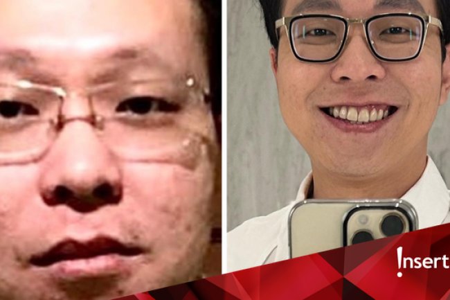 Wajah Bopeng Terungkap, Richard Lee: Aku Sering Pencet Jerawat