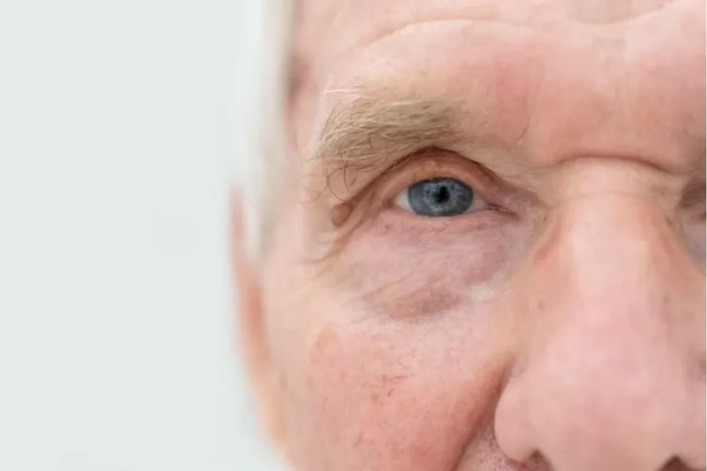 Solusi Hindari Mata Katarak di Usia Tua, Salah Satunya Hindari Alkohol