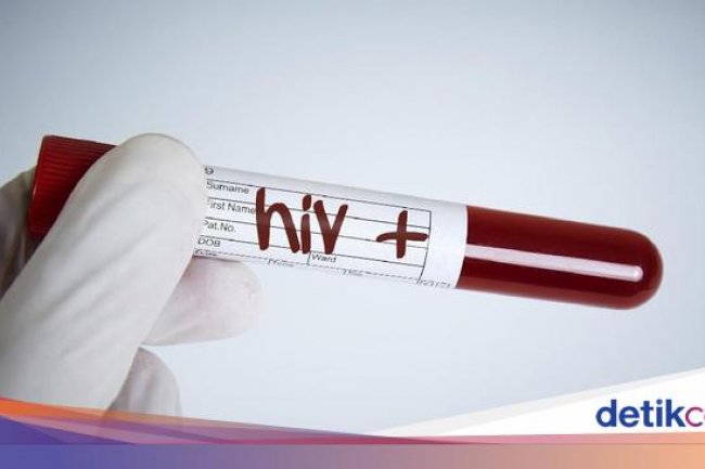 168 Warga Garut Idap HIV/AIDS, Mayoritas gegara Hubungan Sejenis