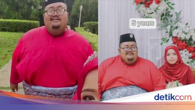 Viral Istri Setia Dampingi Suami Obesitas 300 Kg, Curhat Sering Diejek