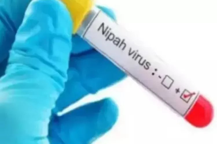 Belum Ada Temuan Virus Nipah di Sukoharjo, Dinkes Imbau Tetap Waspada