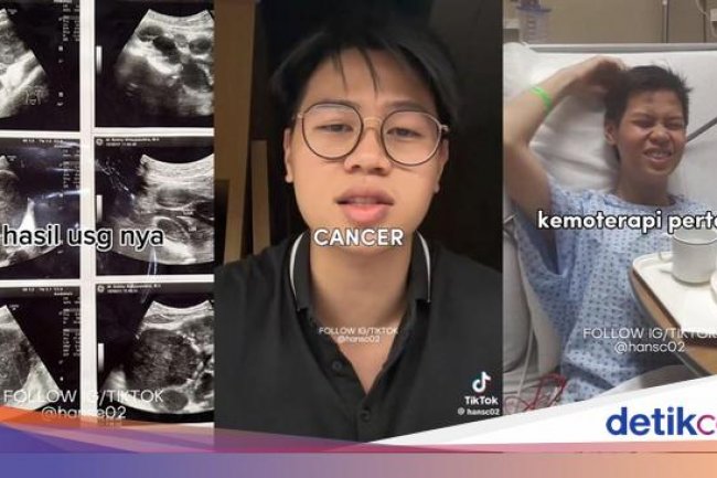 Viral Pria Curhat Sering 'Beser' Tak Tahunya Gejala Awal Kanker Limfoma