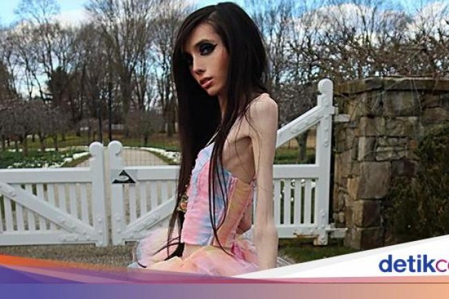 YouTuber Anoreksia Terlihat Makin Kurus & Memprihatinkan, Netizen Telepon 911