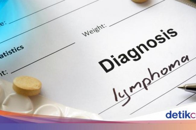 Mengenal Kanker Limfoma, Diidap Pria 21 Tahun yang Keluhkan Sering 'Beser'