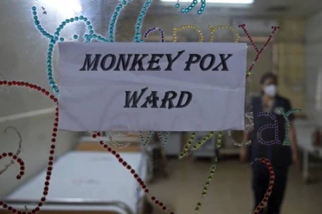 Kasus Cacar Monyet Terus Bertambah, Dinkes DKI Minta Masyarakat Waspada