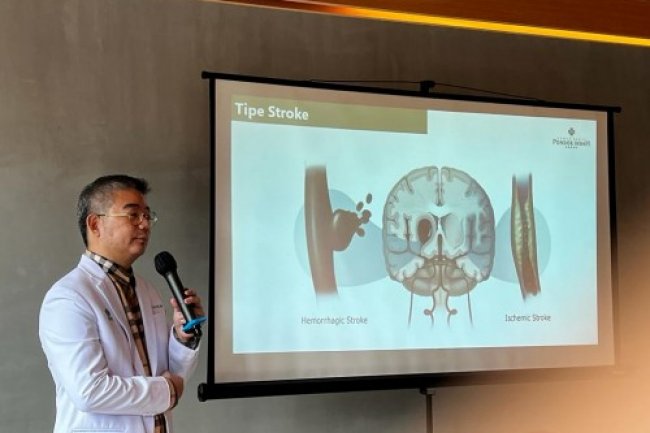 Bukan Stroke Ringan atau Berat, Begini Istilah yang Benar dalam Dunia Medis