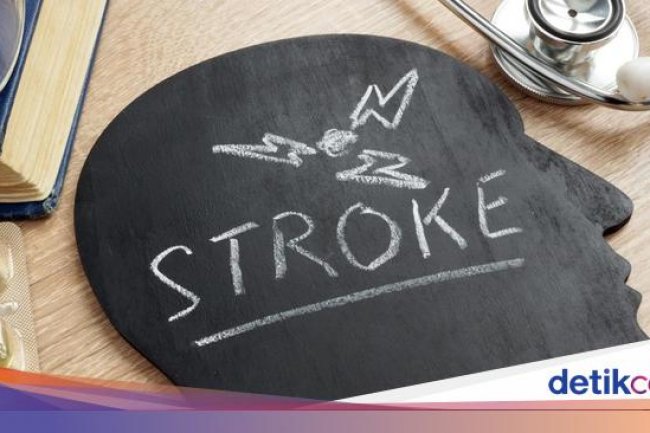 Tanda Serangan Stroke Sering Muncul Pagi Hari, Mitos atau Fakta? Ini Kata Dokter