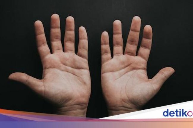 Kenapa Tangan Sering Berkeringat? Ini Penyebab dan Cara Mengatasinya