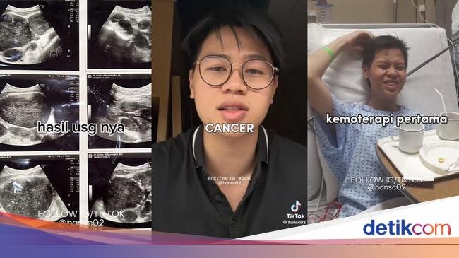 Viral Pria Curhat Sering 'Beser' Tak Tahunya Gejala Awal Kanker Limfoma