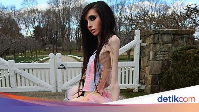 YouTuber Anoreksia Terlihat Makin Kurus & Memprihatinkan, Netizen Telepon 911