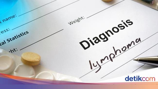 Mengenal Kanker Limfoma, Diidap Pria 21 Tahun yang Keluhkan Sering 'Beser'