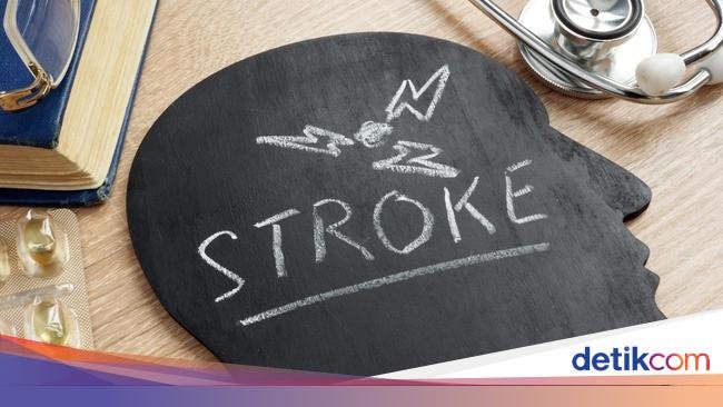 Tanda Serangan Stroke Sering Muncul Pagi Hari, Mitos atau Fakta? Ini Kata Dokter