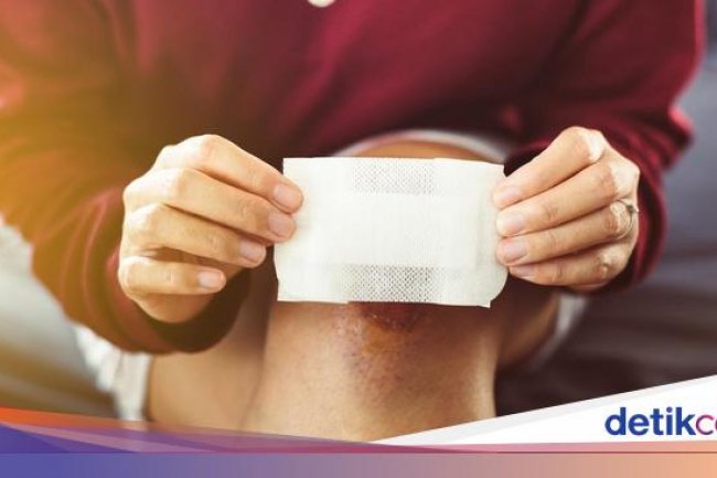 10 Obat Luka Bernanah yang Mudah Ditemui dan Aman Digunakan