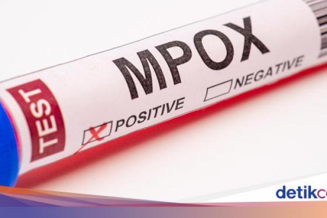 Kasus Cacar Monyet di DKI Jakarta Bertambah Jadi 41 Orang