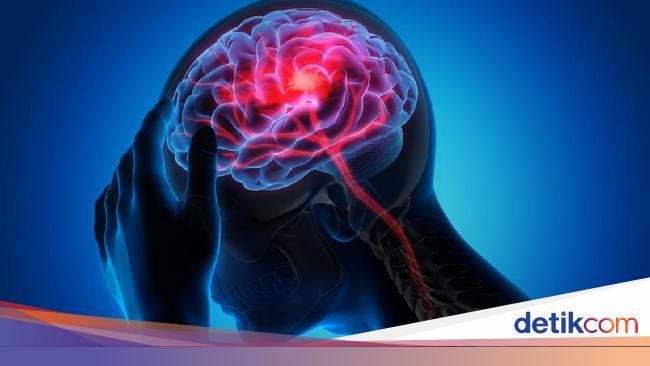 Wanita Ngeluh Sakit Kepala 3 Hari Dikira 'Cuma' Migrain, Rupanya Ada Tumor Otak