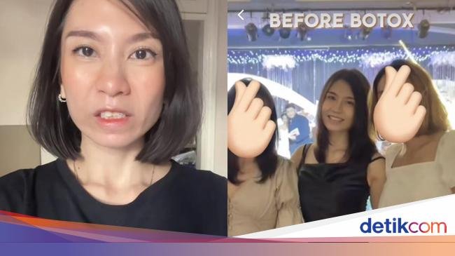 Bikin Wanita di Solo Tak Bisa Tertawa, Harus Apa Jika 'Gagal Botox'?