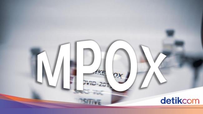Kondisi Terkini 1 Pasien Mpox Gejala Berat yang Sempat Sesak Napas