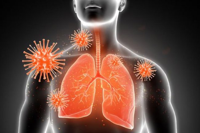 Sudah Ada Kasus Mycoplasma Pneumoniae di DKI, Ini Kata Dinkes