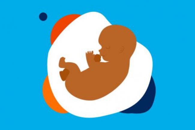 Peneliti Temukan Pola Cacat Lahir pada Bayi