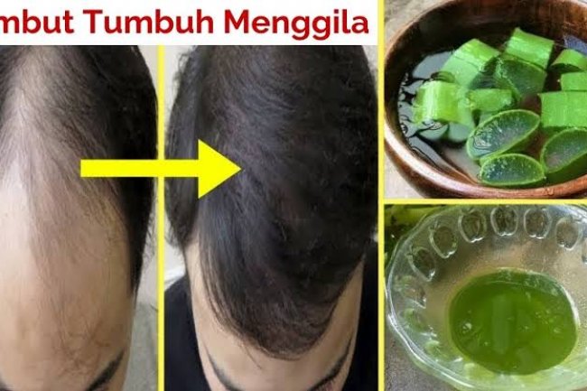 Gak Perlu Perawatan Mahal, Cukup Gunakan Lidah Buaya Atasi Rambut Rontok, Dijamin Rambut Lebat dan Kuat