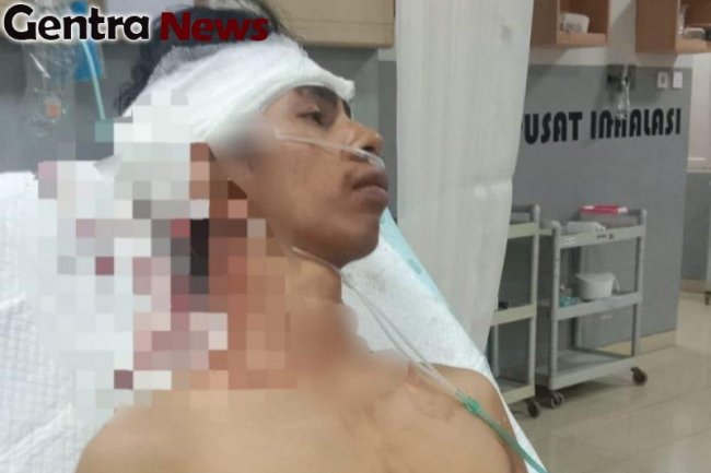 Peristiwa Penebasan Komang MB di Denpasar, ini Kronologinya