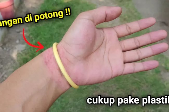 Trik Cara Melepaskan Gelang yang Susah Lepas, Ide Kreatif Ini Bisa Menjadi Solusi Buat Kamu