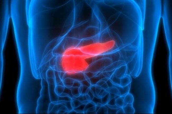 Guru Besar UI: Cegah Kanker Pankreas, Hindari Gaya Hidup Sedenter