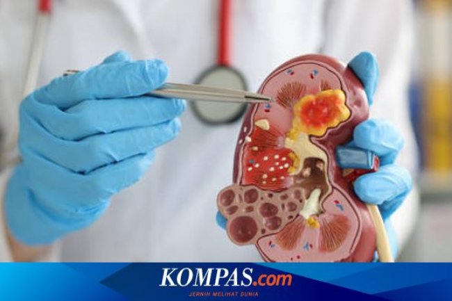 Apa Warna Urine yang Menandakan Gagal Ginjal?