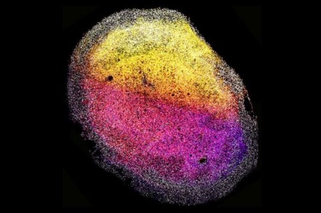 Perdana, Pakar Ciptakan Otak Mini dari Janin Manusia