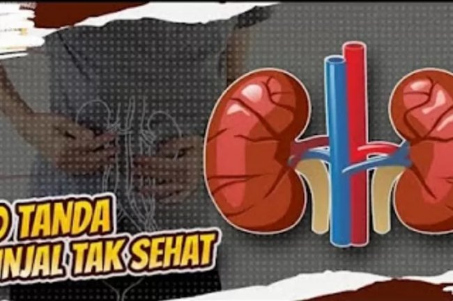 Kata Dokter: Beginilah Cara Mengetahui Ciri-Ciri Ginjal Mulai Bermasalah, Wajib Perhatikan Karena Ini Penyakit Berbahaya Bagi Kesehatan