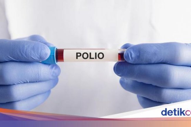 Imunisasi Polio di Solo Tembus 100,09%, Sebut Tak Ada Penolakan