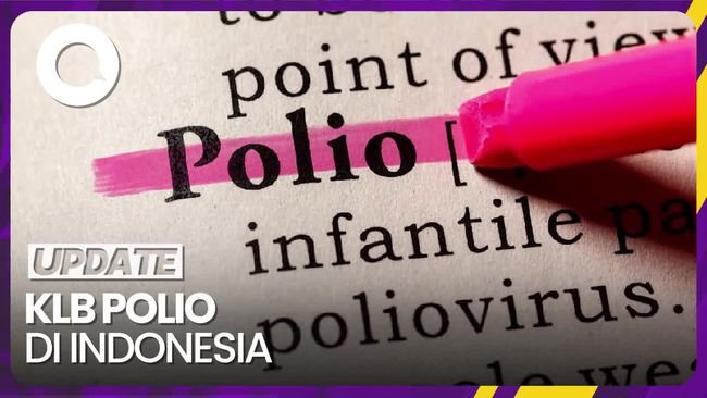 Kemenkes RI: Satu Kasus Polio Ditemukan Dianggap KLB