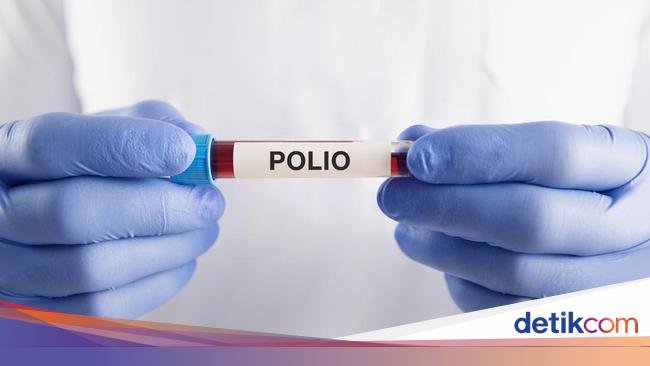 Imunisasi Polio di Solo Tembus 100,09%, Sebut Tak Ada Penolakan