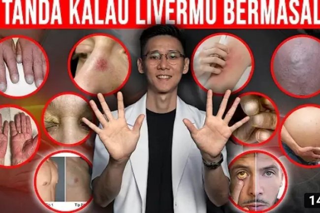 Inilah 10 Tanda pada Kulit yang Menandakan Ada Masalah pada Liver atau Hati