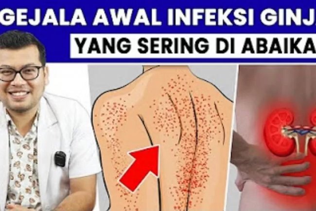 Kata Dokter, Inilah 6 Gejala Awal Penyakit Infeksi Ginjal Yang Sering Diabaikan, Masalah Sepele Tapi Mengancam Kesehatan