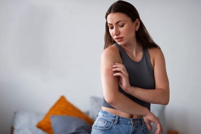 Cara Mengatasi Penyakit Kulit Eksim, Psoriasis, dan Dermatitis dengan Memperbaiki Kesehatan Metabolik 