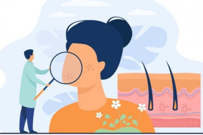 Me Time by Kata Dokter: Serba-serbi Kanker Kulit, Gejala, Penyebab, Pengobatan, Cara Mencegah