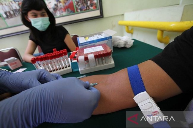 Kota Yogyakarta berkomitmen wujudkan "zero" HIV/AIDS 2030