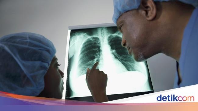 Hari Radiologi Internasional 8 November: Sejarah dan Cara Memperingati