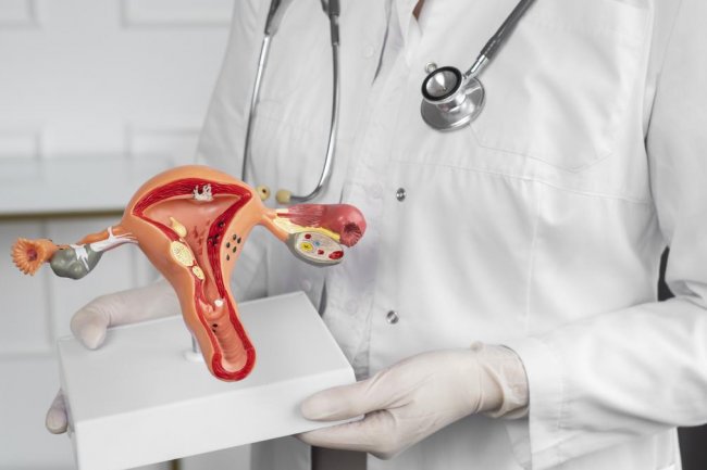 Hi Ladies, Kenali 4 Penyebab Kanker Serviks