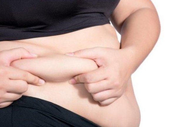 Bahaya Obesitas bisa Ganggu Fisik dan Mental, Atasi Pakai Rumus CERDIK