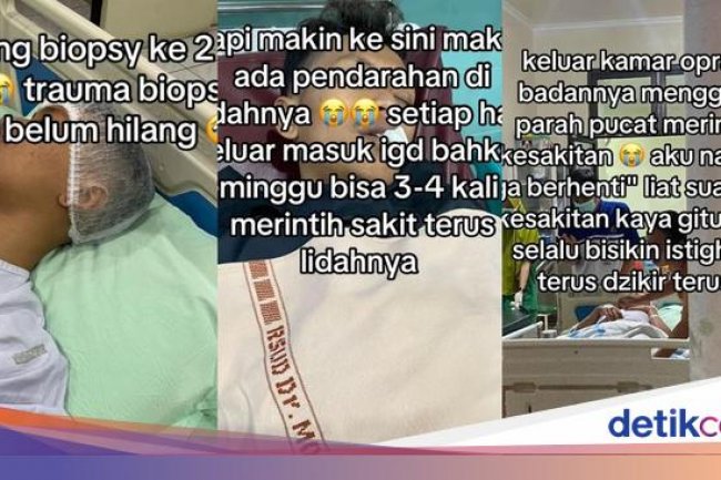 Dialami Pria Solo, Dokter Ungkap Gejala Kanker Lidah yang Muncul di Usia Muda