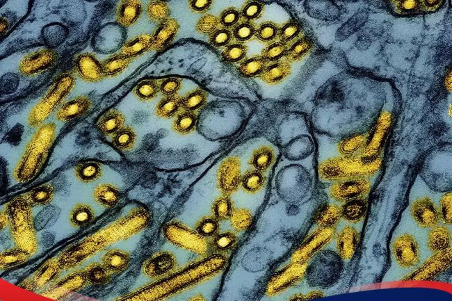 Kasus Flu Burung pada Manusia di Louisiana Picu Kekhawatiran Pandemi di AS