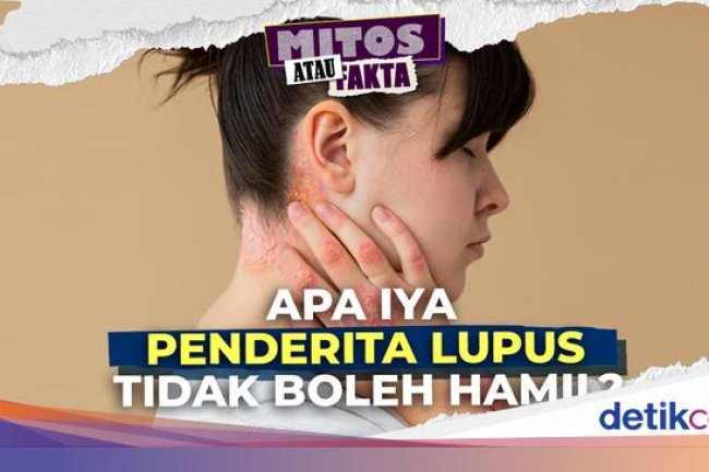 Video Mitos atau Fakta: Penderita Lupus yang Hamil Berpotensi Alami Komplikasi