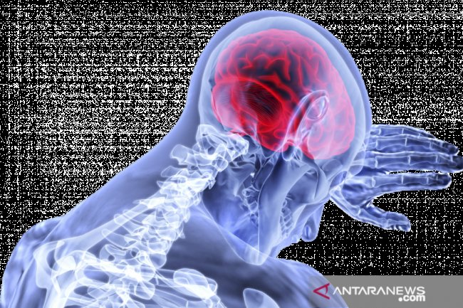 Musim dingin dapat tingkatkan risiko stroke