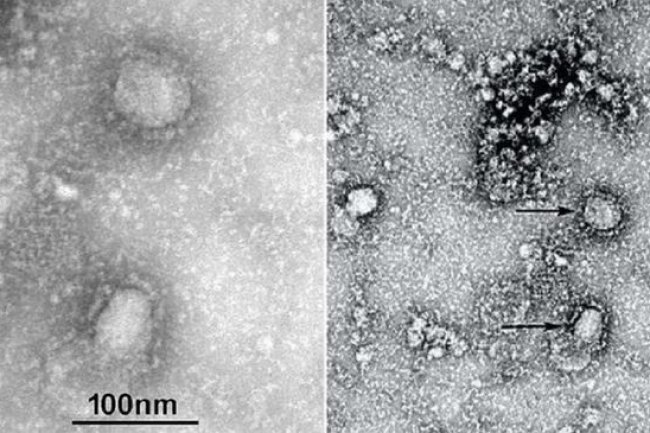 Wabah Flu Ini Sedang Menyebar di AS, Sebabkan 900 Kematian per Tahun