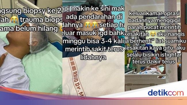 Dialami Pria Solo, Dokter Ungkap Gejala Kanker Lidah yang Muncul di Usia Muda