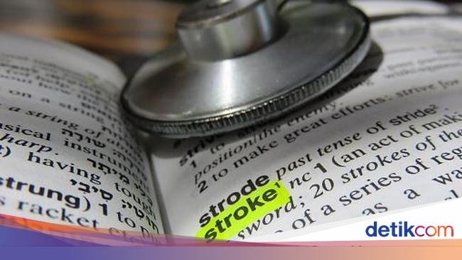 Dokter Ungkap 3 Penyebab Kasus Stroke Usia Muda Makin Marak di RI