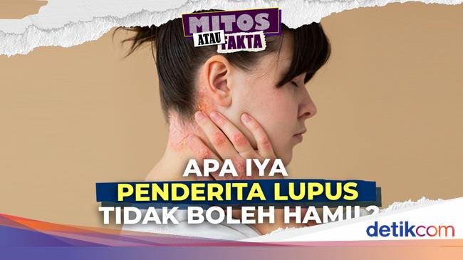 Video Mitos atau Fakta: Penderita Lupus yang Hamil Berpotensi Alami Komplikasi