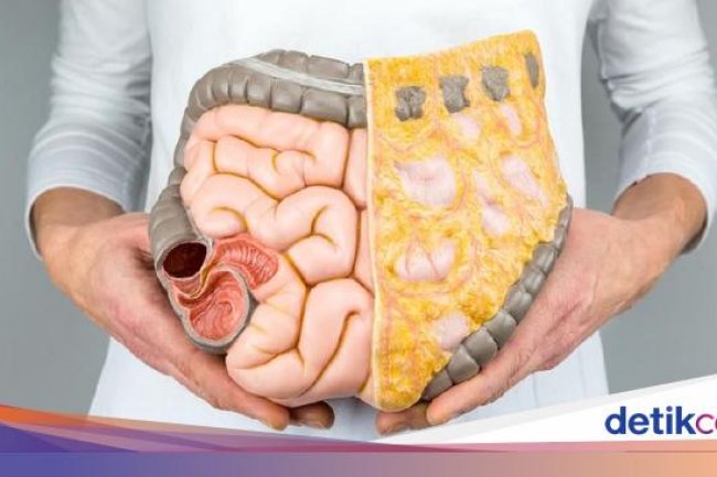 Minuman Ini Terbukti Bisa Cegah Kanker Usus Besar, Cocok Diminum di Pagi Hari